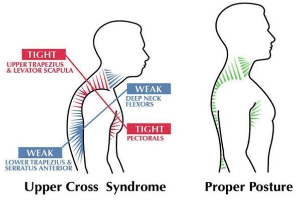 'Banyapúpot' -ról szóló cikk | Kezelésére Masszázs Győr -ben